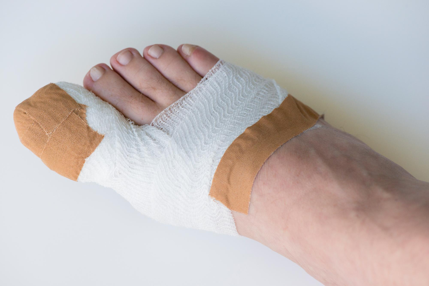 foot surgery recovery