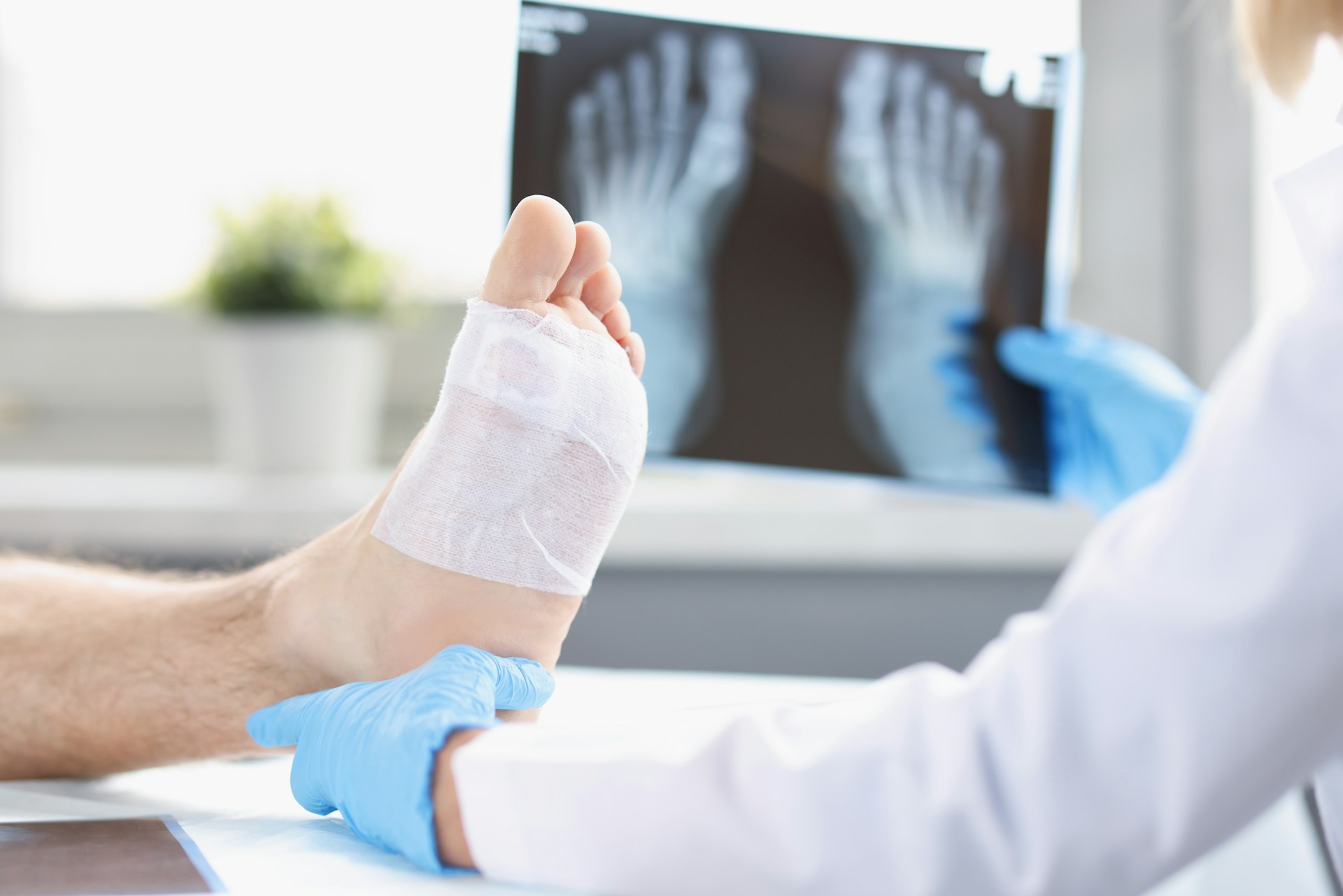 Foot Injuries and Pain